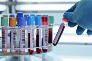 Xét nghiệm máu có giúp phát hiện ung thư?
